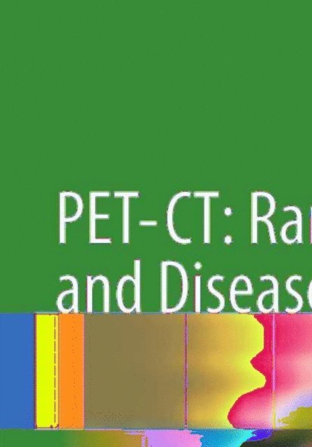 Stefano Fanti, Cristina Nanni - PET-CT: Rare Findings and Diseases, E-bok