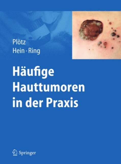 Johannes Ring, Rudiger Hein, Sabine G. Plotz - Häufige Hauttumoren in der Praxis, E-bok