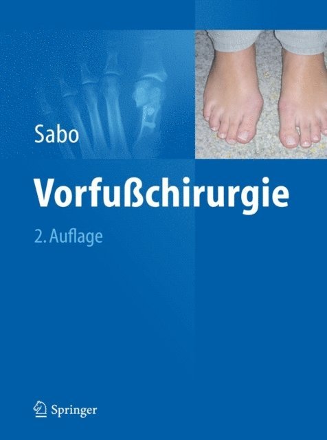 Desiderius Sabo - Vorfußchirurgie, E-bok