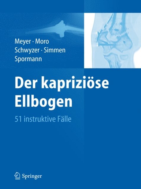Christoph Spormann, Beat Rene Simmen, Hans-Kaspar Schwyzer, Fabrizio Moro, Rainer-Peter Meyer - Der kapriziöse Ellbogen, E-bok