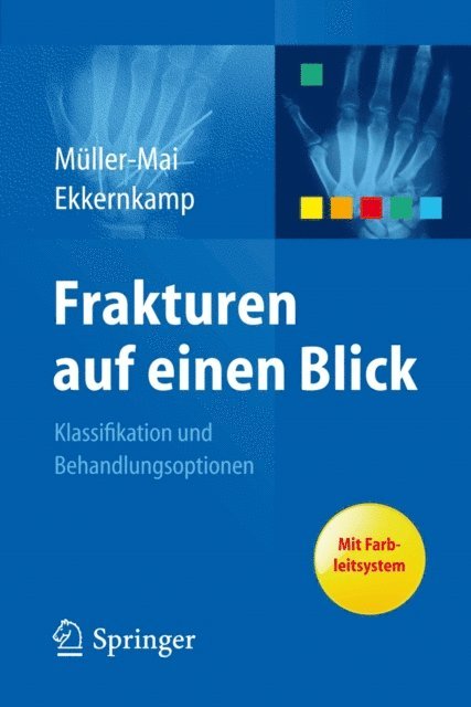 Axel Ekkernkamp, Christian Muller-Mai - Frakturen auf einen Blick, E-bok