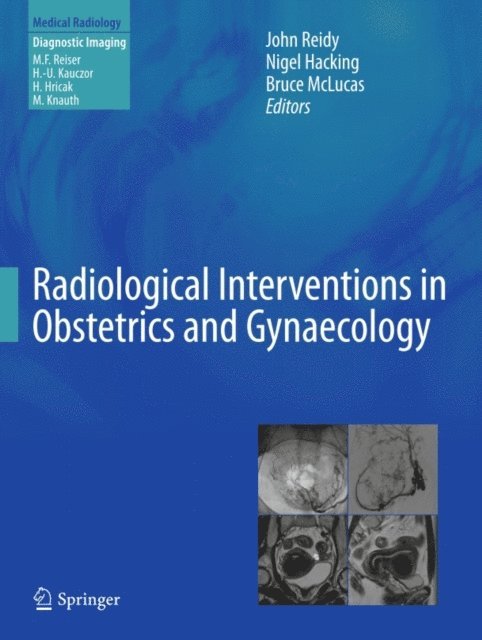 Bruce McLucas, Nigel Hacking, John Reidy - Radiological Interventions in Obstetrics and Gynaecology, E-bok