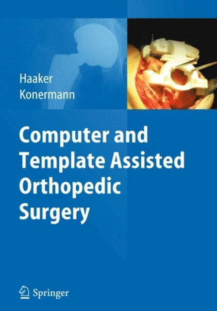 Werner Konermann, Rolf Haaker - Computer and Template Assisted Orthopedic Surgery, E-bok