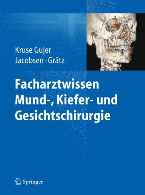 Klaus W. Gratz, Christine Jacobsen, Astrid Kruse Gujer - Facharztwissen Mund-, Kiefer- und Gesichtschirurgie, E-bok