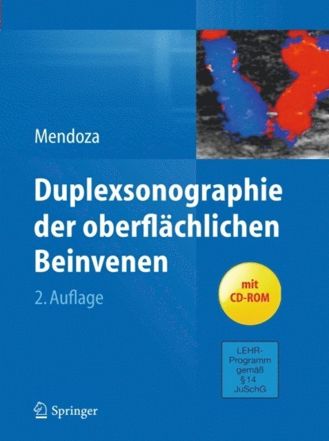 Erika Mendoza - Duplexsonographie der oberflächlichen Beinvenen, E-bok