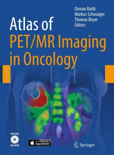 Thomas Beyer, Markus Schwaiger, Osman Ratib - Atlas of PET/MR Imaging in Oncology, E-bok