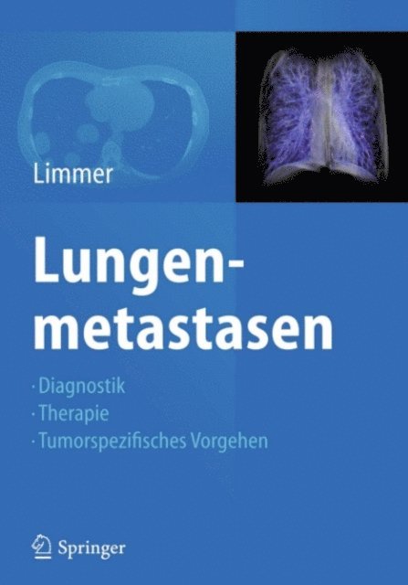 Stefan Limmer - Lungenmetastasen, E-bok