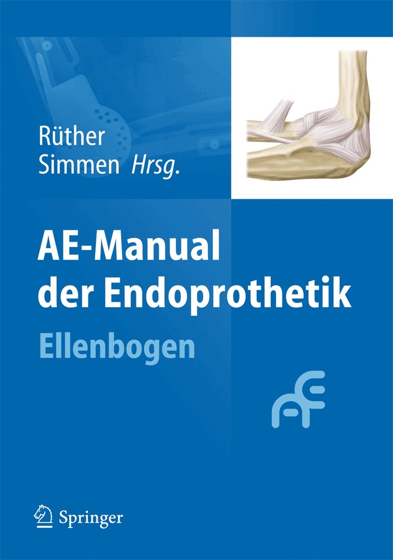 Wolfgang Rüther, Beat R. Simmen - AE-Manual der Endoprothetik, Inbunden