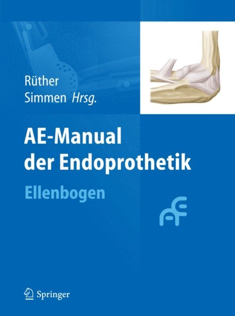 Beat R. Simmen, Wolfgang Ruther - AE-Manual der Endoprothetik, E-bok