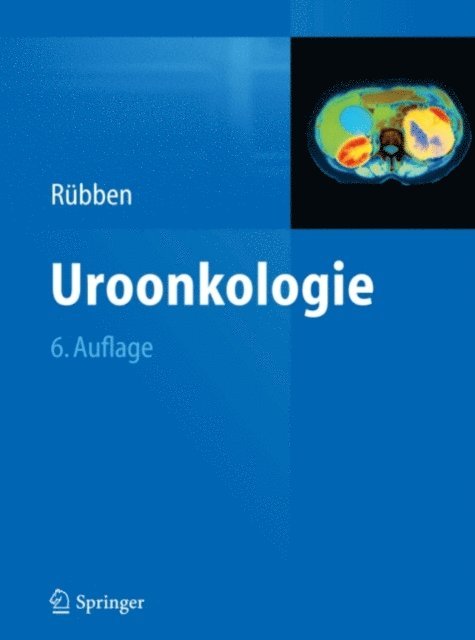 Herbert Rubben - Uroonkologie, E-bok