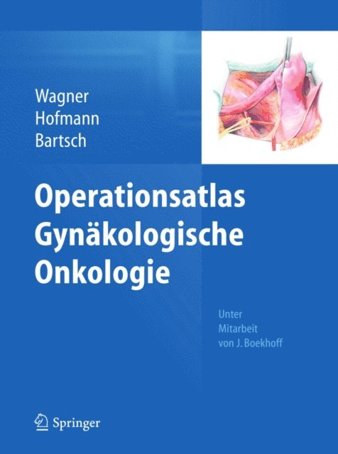 Detlef K. Bartsch, Rainer Hofmann, Uwe Wagner - Operationsatlas Gynäkologische Onkologie, E-bok