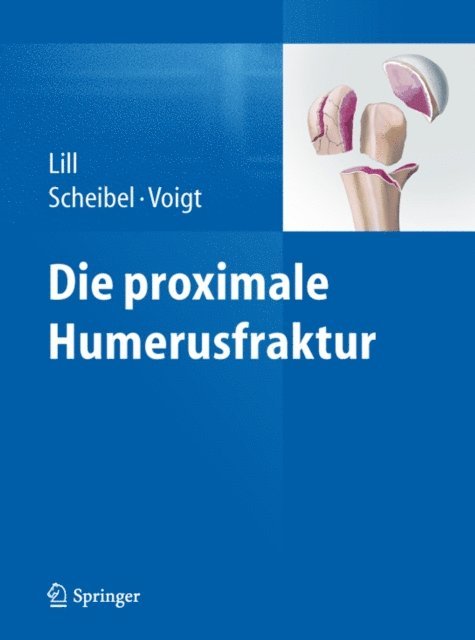 Christine Voigt, Markus Scheibel, Helmut Lill - Die proximale Humerusfraktur, E-bok