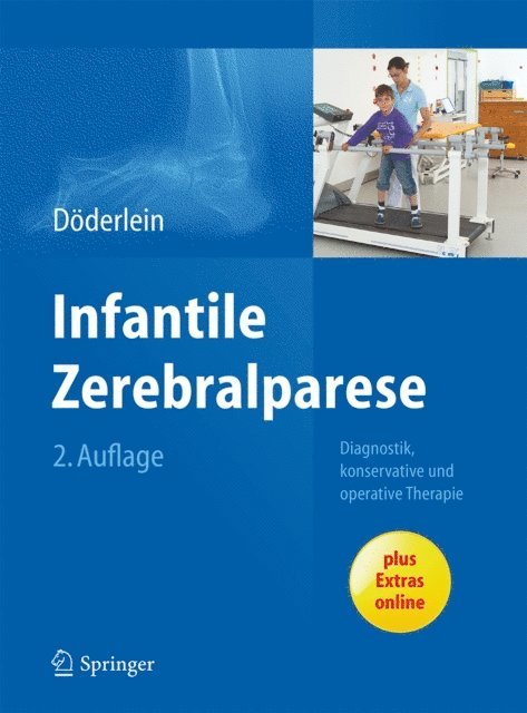 Leonhard Doderlein - Infantile Zerebralparese, E-bok