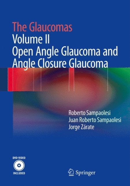 Jorge Zarate, Juan Roberto Sampaolesi, Roberto Sampaolesi - Glaucomas, E-bok