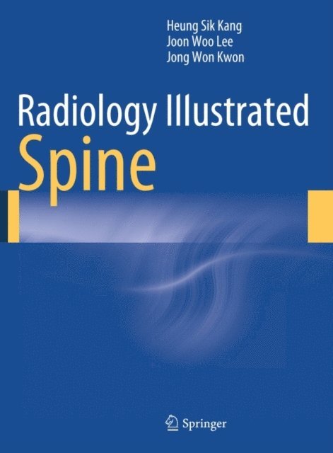 Jong Won Kwon, Joon Woo Lee, Heung Sik Kang - Radiology Illustrated: Spine, E-bok