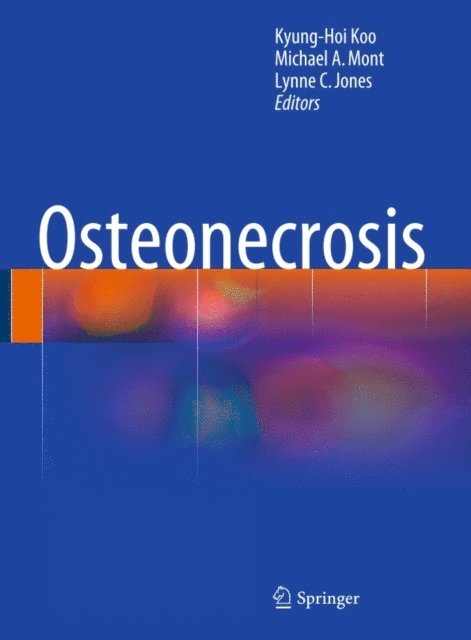 Lynne C. Jones, Michael A. Mont, Kyung-Hoi Koo - Osteonecrosis, E-bok