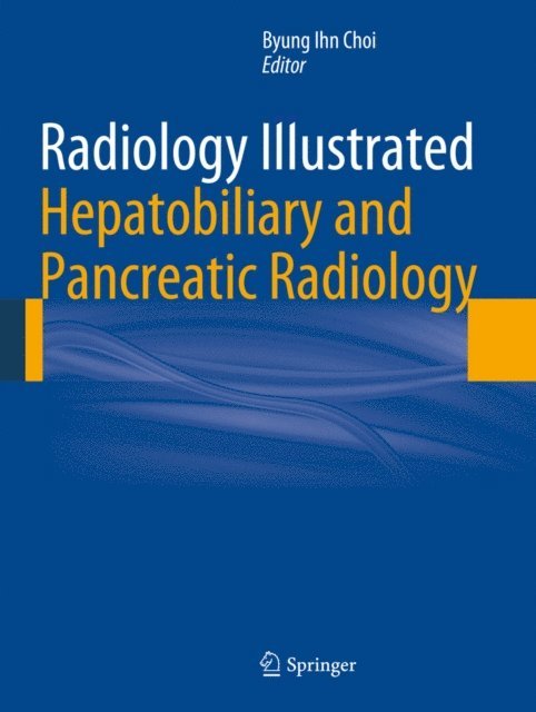 Byung Ihn Choi - Radiology Illustrated: Hepatobiliary and Pancreatic Radiology, E-bok