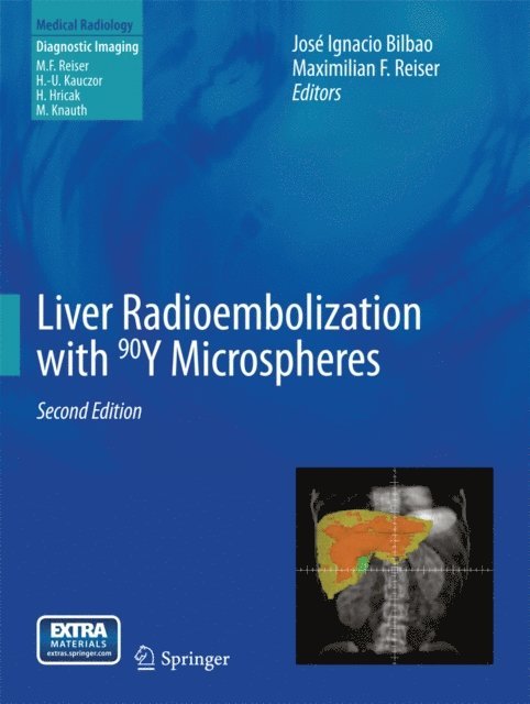 Maximilian F Reiser, Jose Ignacio Bilbao - Liver Radioembolization with 90Y Microspheres, E-bok