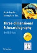 Three-dimensional Echocardiography