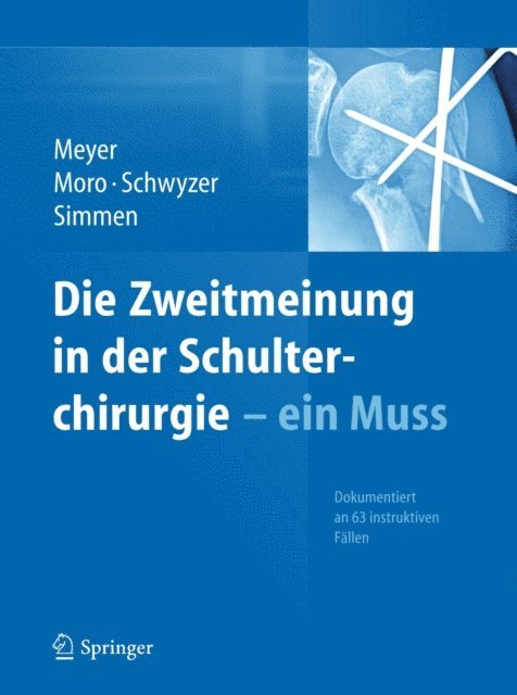 Beat Simmen, Hans-Kaspar Schwyzer, Fabrizio Moro, Rainer Peter Meyer - Die Zweitmeinung in der Schulterchirurgie - ein Muss, E-bok
