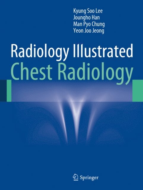 Yeon Joo Jeong, Man Pyo Chung, Joungho Han, Kyung Soo Lee - Radiology Illustrated: Chest Radiology, E-bok