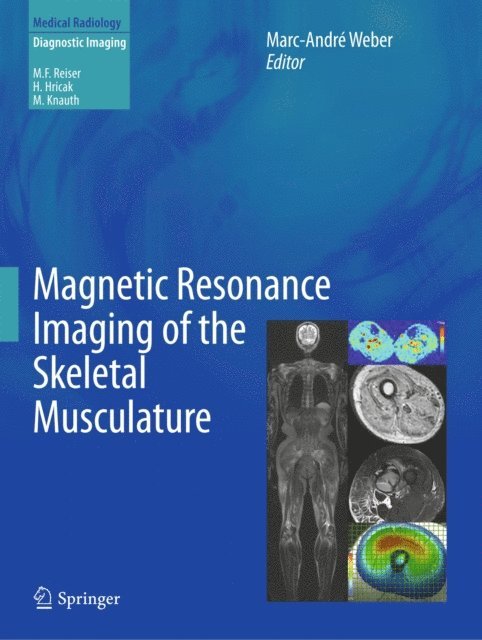Marc-Andre Weber - Magnetic Resonance Imaging of the Skeletal Musculature, E-bok