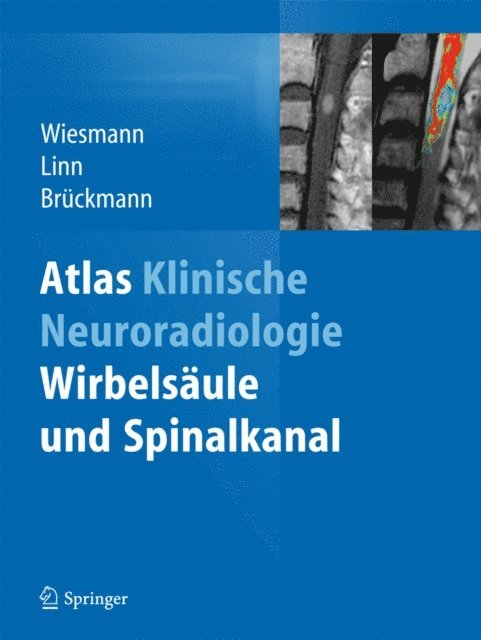 Hartmut Bruckmann, Jennifer Linn, Martin Wiesmann - Atlas Klinische Neuroradiologie, E-bok