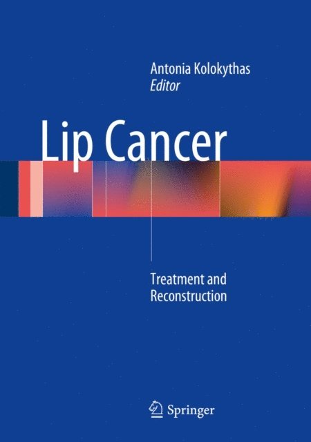 Antonia Kolokythas - Lip Cancer, E-bok