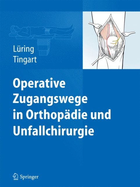 Markus Tingart, Christian Luring - Operative Zugangswege in Orthopädie und Unfallchirurgie, E-bok