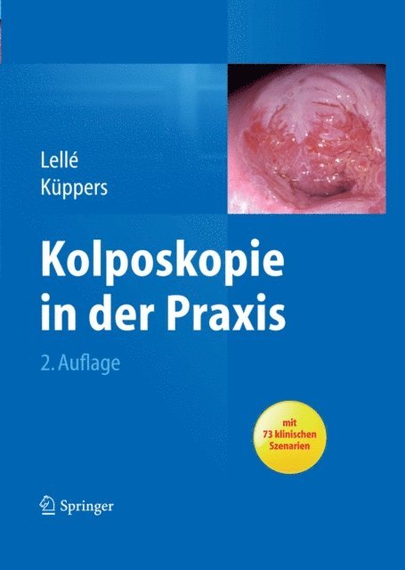 Volkmar Kuppers, Ralph J. Lelle - Kolposkopie in der Praxis, E-bok