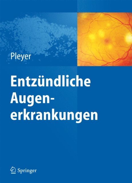 Uwe Pleyer - Entzündliche Augenerkrankungen, E-bok
