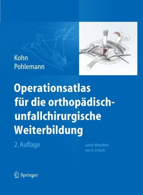 Tim Pohlemann, Dieter Kohn - Operationsatlas für die orthopädisch-unfallchirurgische Weiterbildung, E-bok