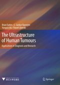 Ultrastructure of Human Tumours