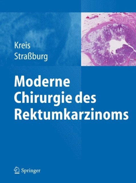 Joachim Straburg, Martin E. Kreis - Moderne Chirurgie des Rektumkarzinoms, E-bok