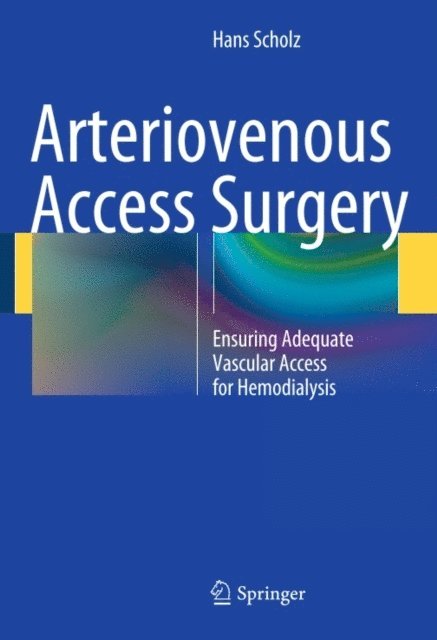 Hans Scholz - Arteriovenous Access Surgery, E-bok. Tillgänglighet: Lägg i varukorg