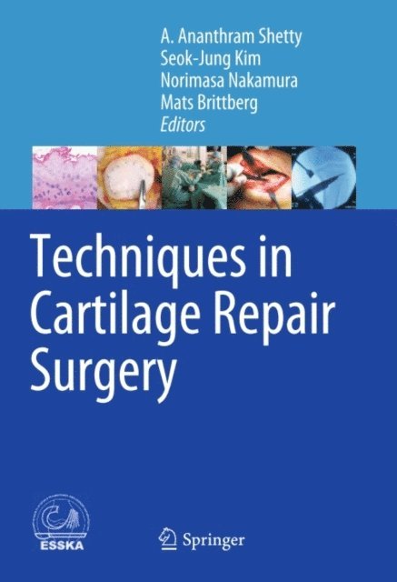 Mats Brittberg, Norimasa Nakamura, Seok-Jung Kim, A. Ananthram Shetty - Techniques in Cartilage Repair Surgery, E-bok
