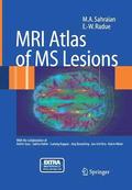MRI Atlas of MS Lesions