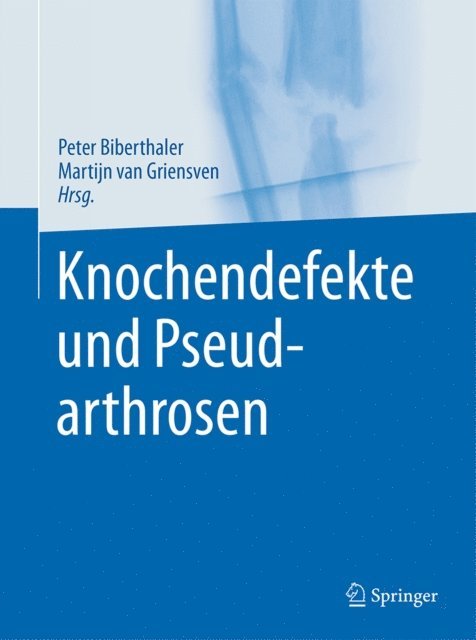 Martijn van Griensven, Peter Biberthaler - Knochendefekte und Pseudarthrosen, E-bok