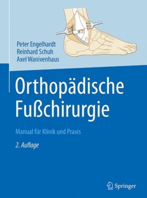 Axel Wanivenhaus, Reinhard Schuh, Peter Engelhardt - Orthopädische Fußchirurgie, E-bok