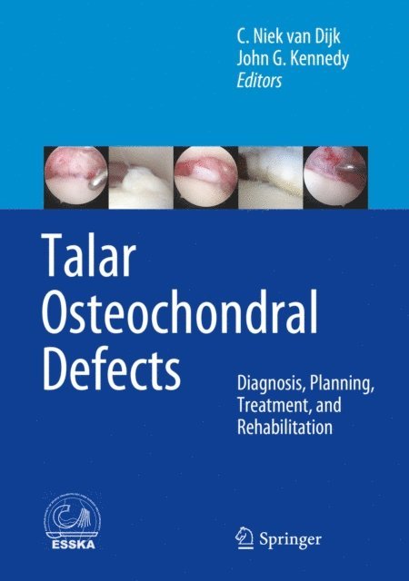 John G. Kennedy, C. Niek van Dijk - Talar Osteochondral Defects, E-bok