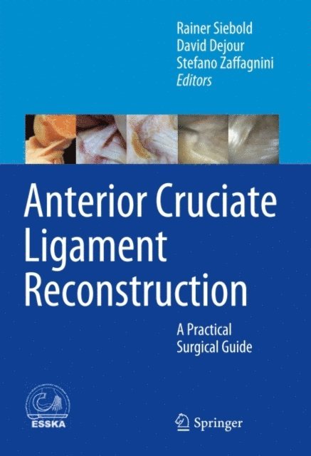 Stefano Zaffagnini, David Dejour, Rainer Siebold - Anterior Cruciate Ligament Reconstruction, E-bok