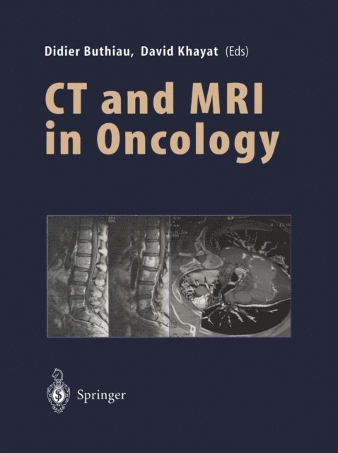 David Khayat, Didier Buthiau - CT and MRI in Oncology, E-bok