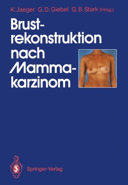 Gerald B. Stark, Gerald D. Giebel, Klaus Jaeger - Brustrekonstruktion nach Mammakarzinom, E-bok
