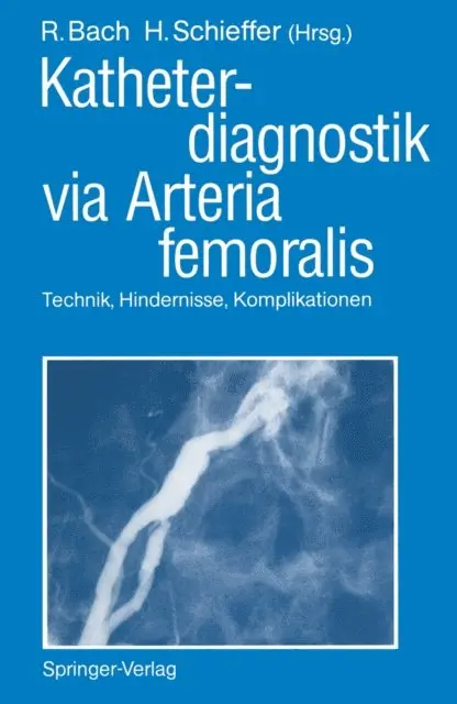 Hermann J. Schieffer, Roland Bach - Katheterdiagnostik via Arteria femoralis, E-bok. Tillgänglighet: Lägg i varukorg