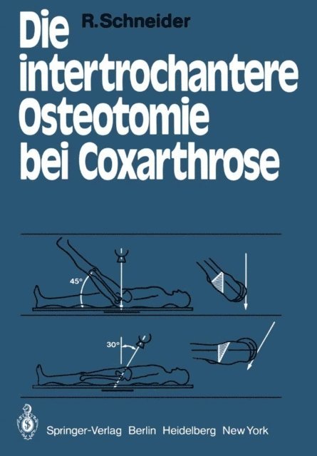 R. Schneider - Die intertrochantere Osteotomie bei Coxarthrose, E-bok
