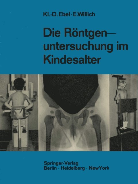 Eberhard Willich, Klaus-Dietrich Ebel - Die Röntgenuntersuchung im Kindesalter, E-bok