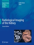 Radiological Imaging of the Kidney