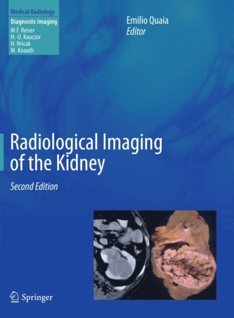 Emilio Quaia - Radiological Imaging of the Kidney, E-bok