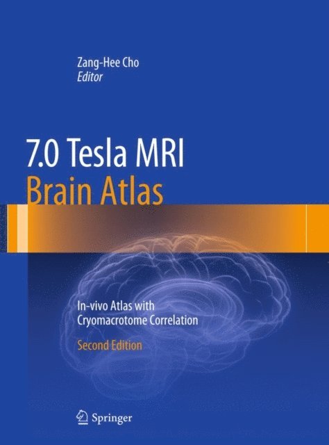 Zang-Hee Cho - 7.0 Tesla MRI Brain Atlas, E-bok