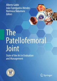 The Patellofemoral Joint